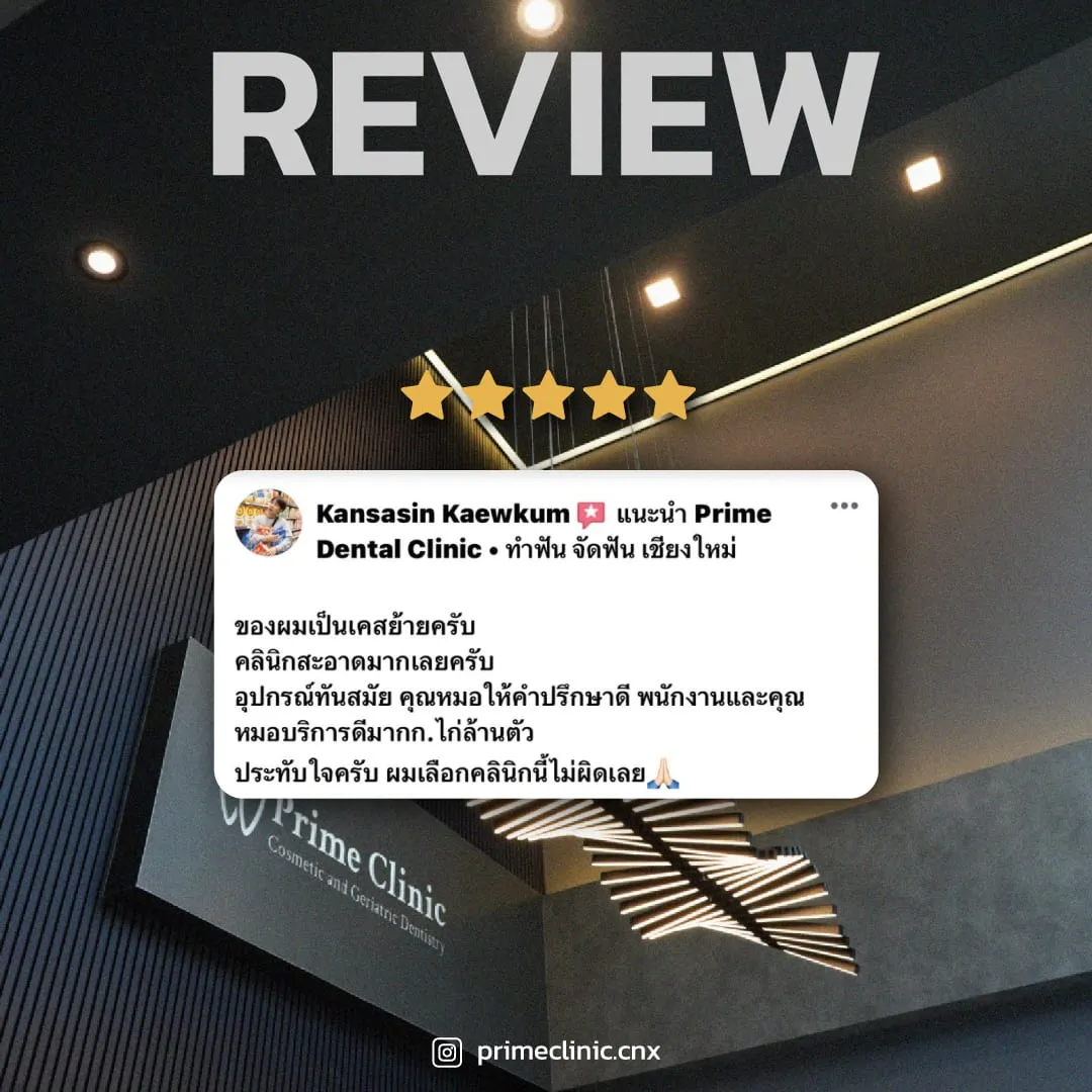 รีวิวจากคนไข้ 1